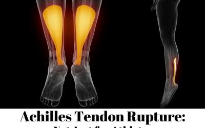 Achilles Tendon Rupture…Not Just for Athletes